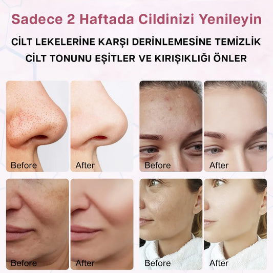 Leke Karşıtı Kojik Asit Zerdeçal Yüz Temizleme Pedi